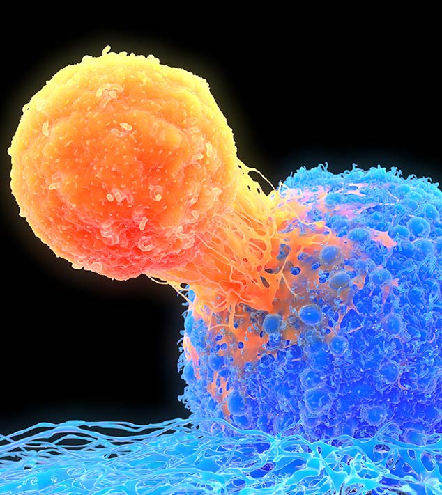 CAR T-cell attacking a cancer cell